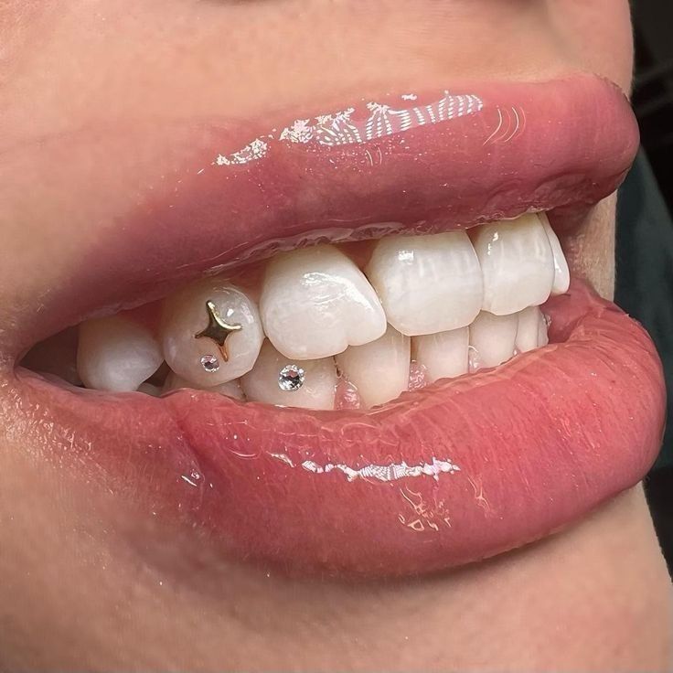 ت