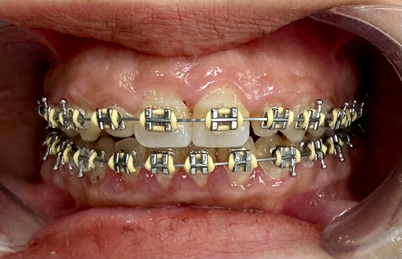 Orthodontics
