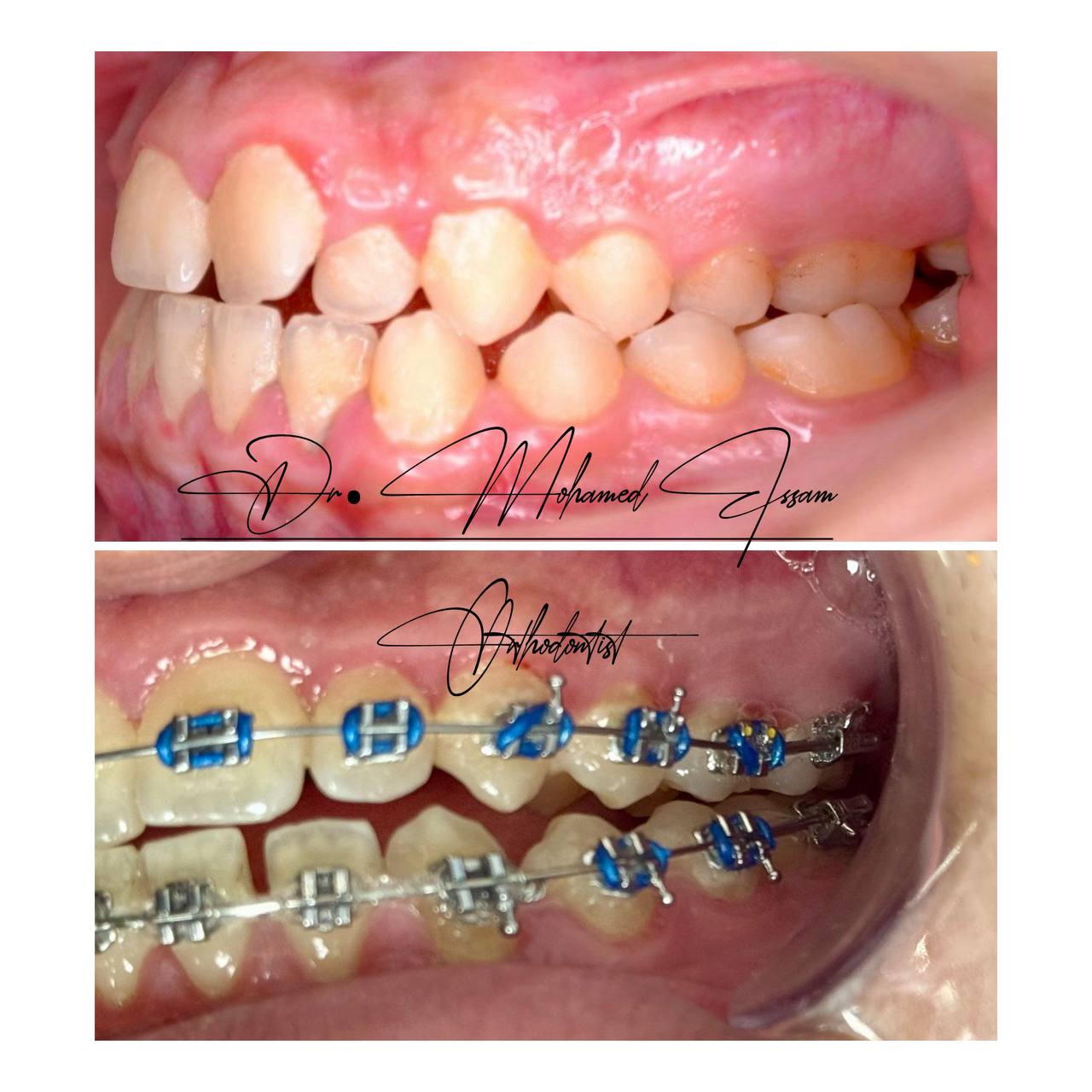 3 months progress