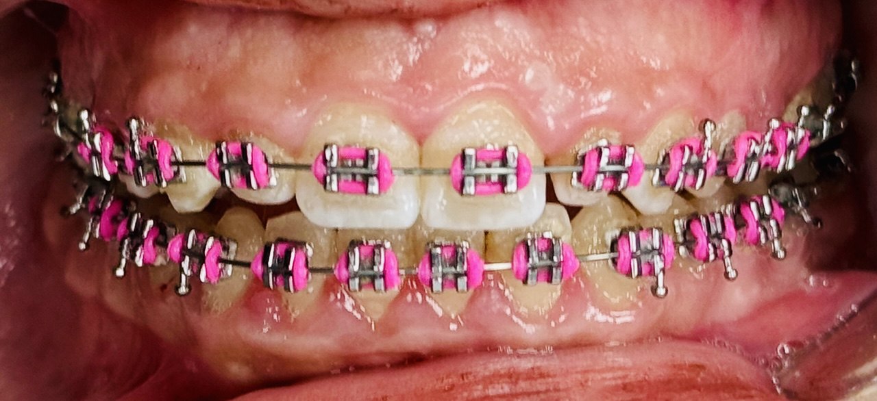Orthodontics